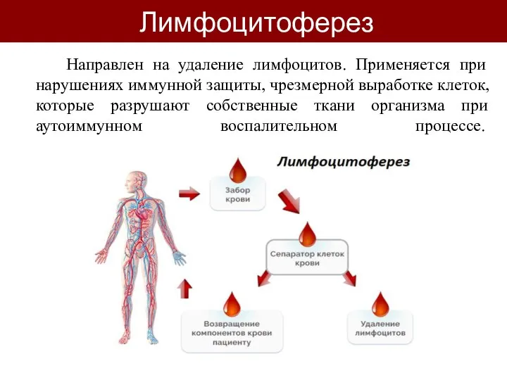 Лимфоцитоферез Направлен на удаление лимфоцитов. Применяется при нарушениях иммунной защиты, чрезмерной