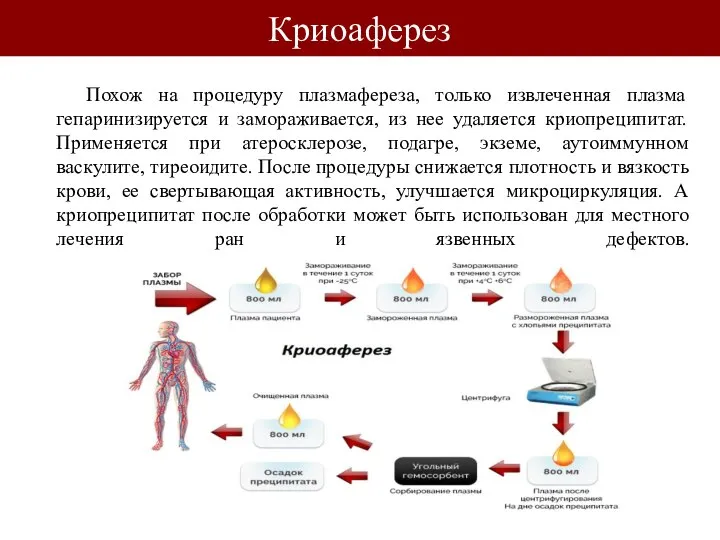 Похож на процедуру плазмафереза, только извлеченная плазма гепаринизируется и замораживается, из