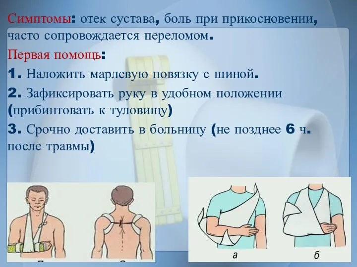 Симптомы: отек сустава, боль при прикосновении, часто сопровождается переломом. Первая помощь: