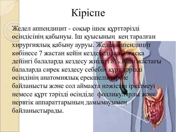 Кіріспе Жедел аппендицит - соқыр ішек құрттəрізді өсіндісінің қабынуы. Іш қуысының