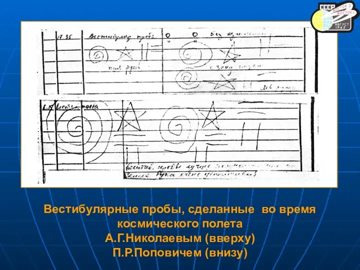 Вестибулярные пробы, сделанные во время космического полета А.Г.Николаевым (вверху) П.Р.Поповичем (внизу)