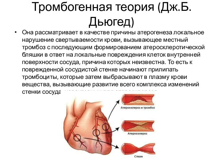 Тромбогенная теория (Дж.Б.Дьюгед) Она рассматривает в качестве причины атерогенеза локальное нарушение