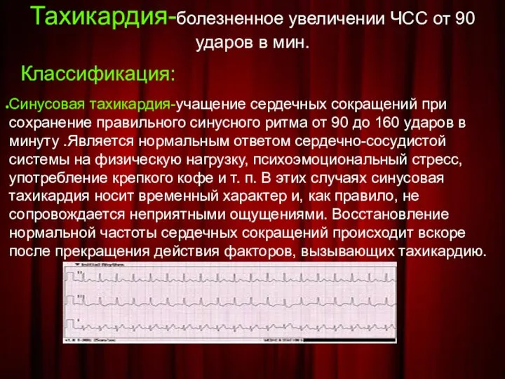 Тахикардия-болезненное увеличении ЧСС от 90 ударов в мин. Классификация: Синусовая тахикардия-учащение