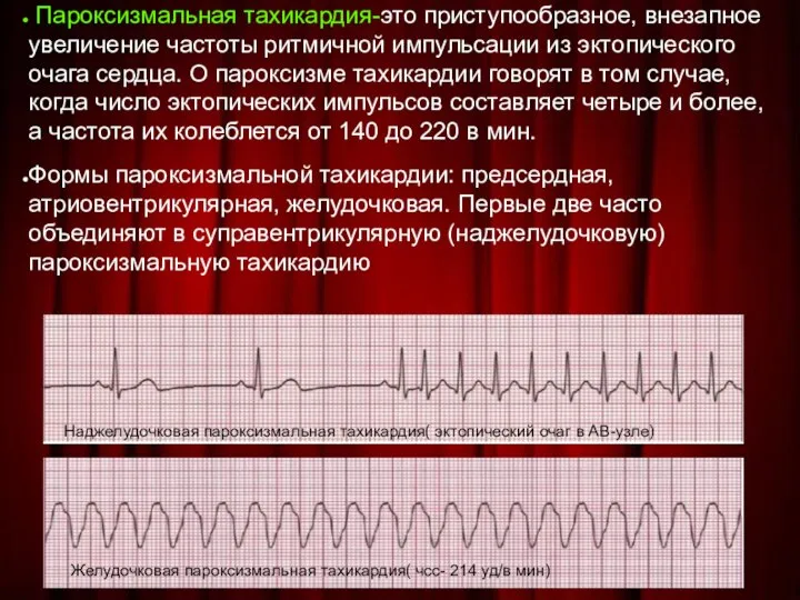 Пароксизмальная тахикардия-это приступообразное, внезапное увеличение частоты ритмичной импульсации из эктопического очага