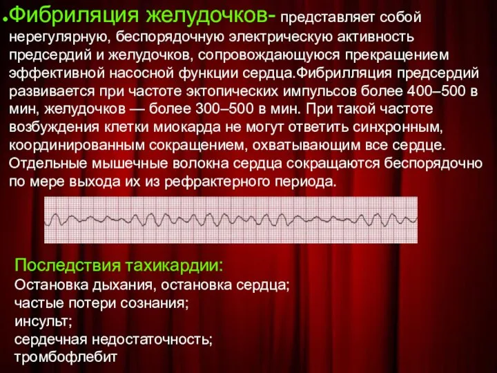 Фибриляция желудочков- представляет собой нерегулярную, беспорядочную электрическую активность предсердий и желудочков,