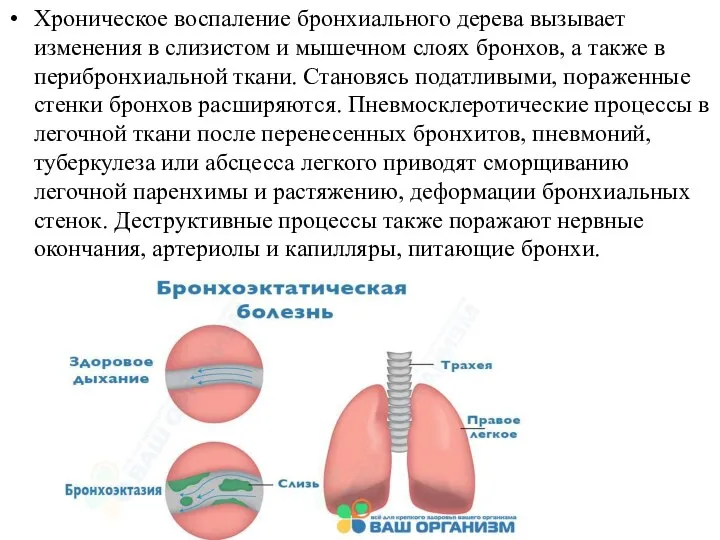 Хроническое воспаление бронхиального дерева вызывает изменения в слизистом и мышечном слоях