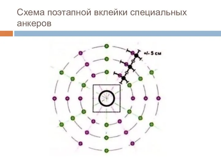 Схема поэтапной вклейки специальных анкеров