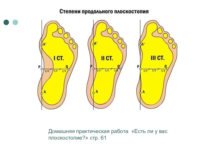 Домашняя практическая работа «Есть ли у вас плоскостопие?» стр. 61