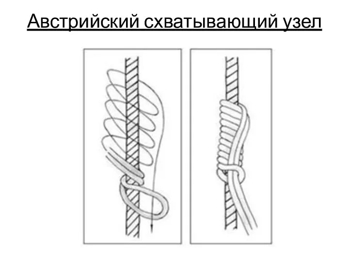 Австрийский схватывающий узел