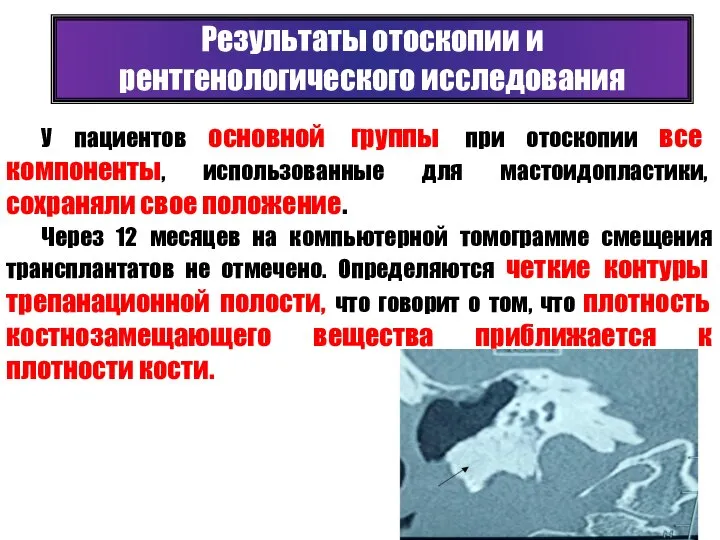 У пациентов основной группы при отоскопии все компоненты, использованные для мастоидопластики,