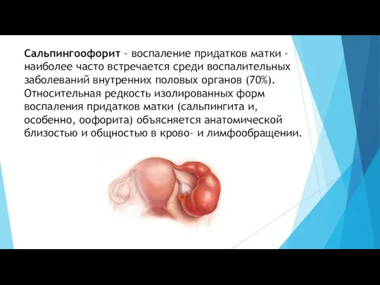 Сальпингоофорит - воспаление придатков матки - наиболее часто встречается среди воспалительных