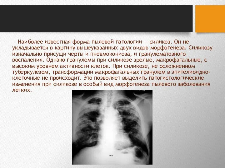 Наиболее известная форма пылевой патологии — силикоз. Он не укладывается в