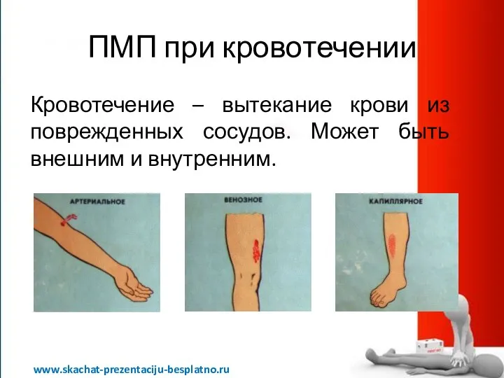 ПМП при кровотечении Кровотечение – вытекание крови из поврежденных сосудов. Может быть внешним и внутренним. www.skachat-prezentaciju-besplatno.ru