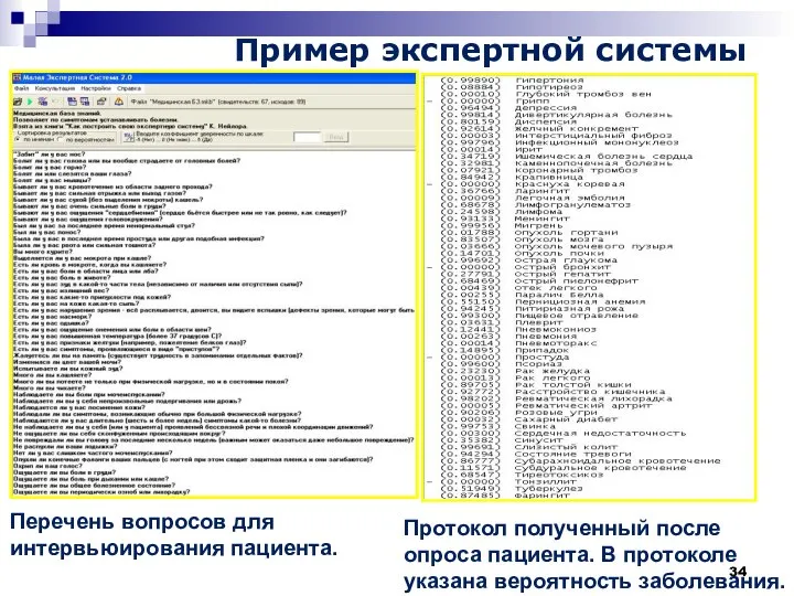 Пример экспертной системы Перечень вопросов для интервьюирования пациента. Протокол полученный после