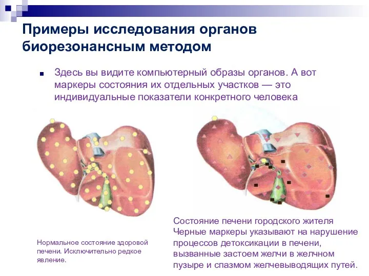 Примеры исследования органов биорезонансным методом Здесь вы видите компьютерный образы органов.