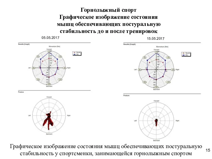 Горнолыжный спорт Графическое изображение состояния мышц обеспечивающих постуральную стабильность до и