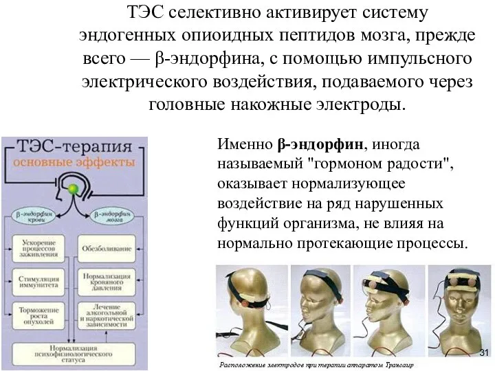 ТЭС селективно активирует систему эндогенных опиоидных пептидов мозга, прежде всего —