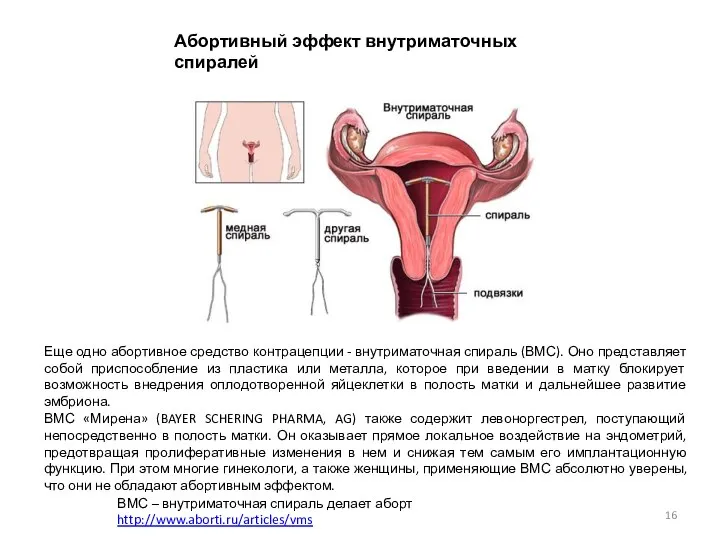Абортивный эффект внутриматочных спиралей ВМС – внутриматочная спираль делает аборт http://www.aborti.ru/articles/vms