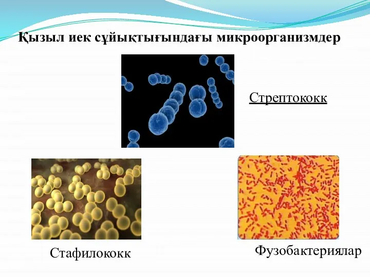 Қызыл иек сұйықтығындағы микроорганизмдер Стрептококк Стафилококк Фузобактериялар