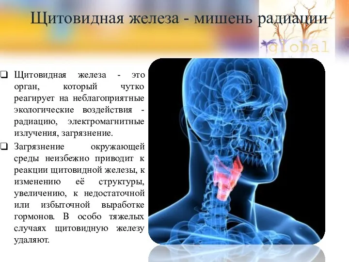 Щитовидная железа - мишень радиации Щитовидная железа - это орган, который