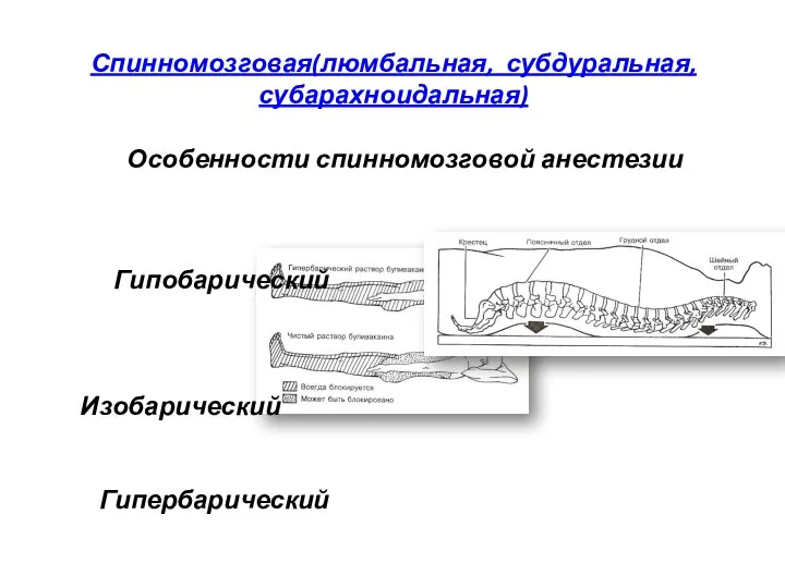 Спинномозговая(люмбальная, субдуральная, субарахноидальная) Особенности спинномозговой анестезии Гипобарический Изобарический Гипербарический