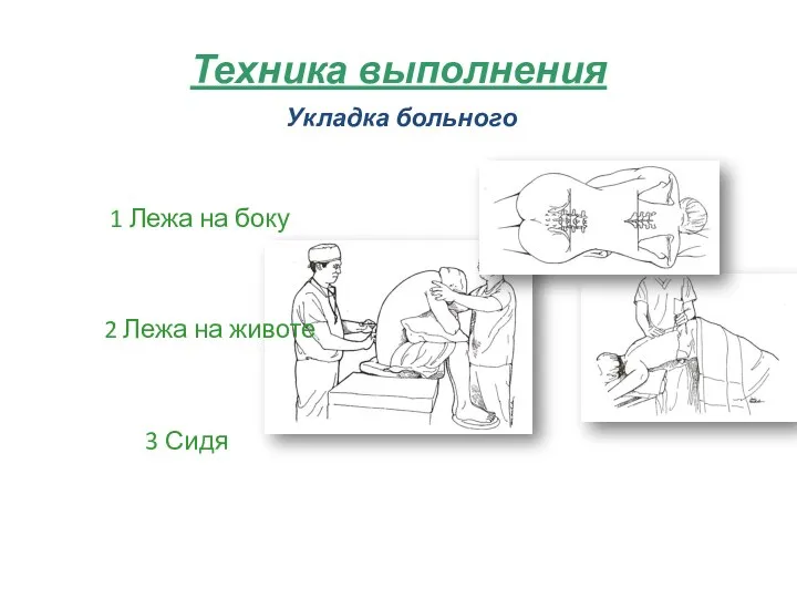 Техника выполнения Укладка больного 1 Лежа на боку 2 Лежа на животе 3 Сидя