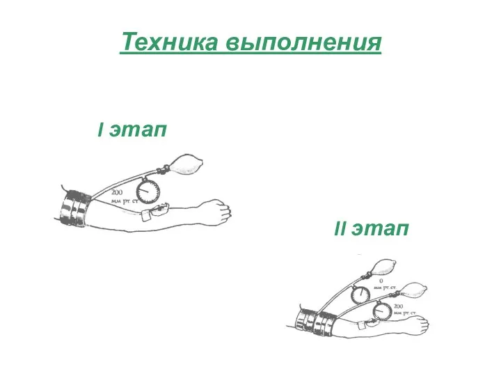 Техника выполнения I этап II этап