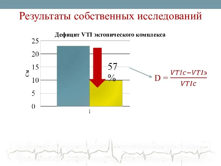 Результаты собственных исследований Дефицит VTI эктопического комплекса