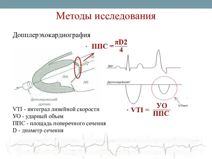 Методы исследования Допплерэхокардиография VTI - интеграл линейной скорости УО - ударный