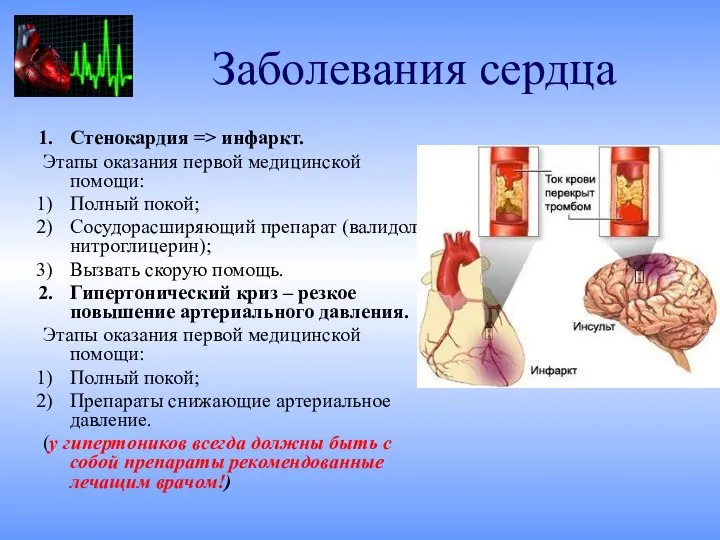 Заболевания сердца Стенокардия => инфаркт. Этапы оказания первой медицинской помощи: Полный