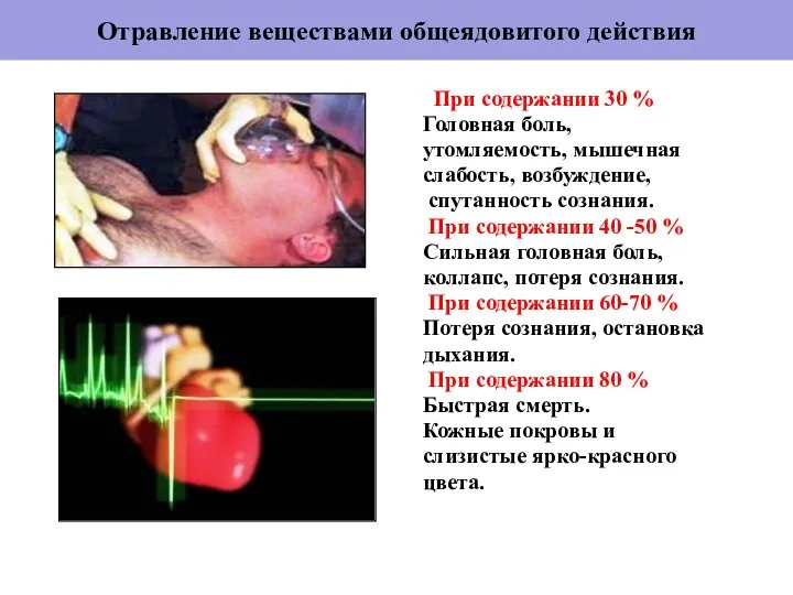 Отравление веществами общеядовитого действия При содержании 30 % Головная боль, утомляемость,