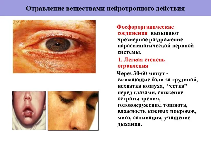 Отравление веществами нейротропного действия Фосфорорганические соединения вызывают чрезмерное раздражение парасимпатической нервной
