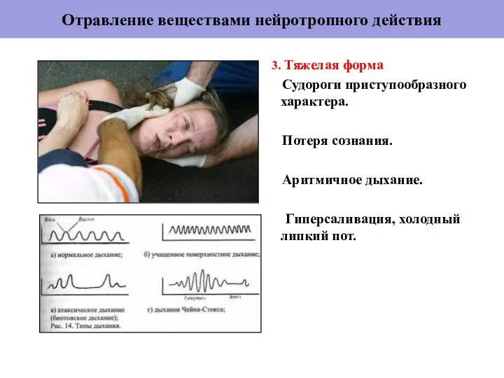 Отравление веществами нейротропного действия 3. Тяжелая форма Судороги приступообразного характера. Потеря