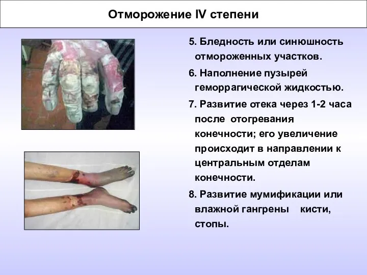 Отморожение IV степени 5. Бледность или синюшность отмороженных участков. 6. Наполнение