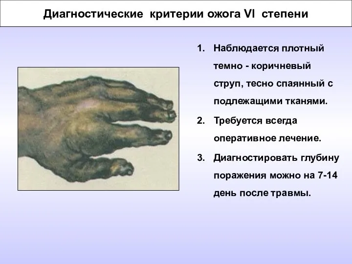 Диагностические критерии ожога VI степени Наблюдается плотный темно - коричневый струп,