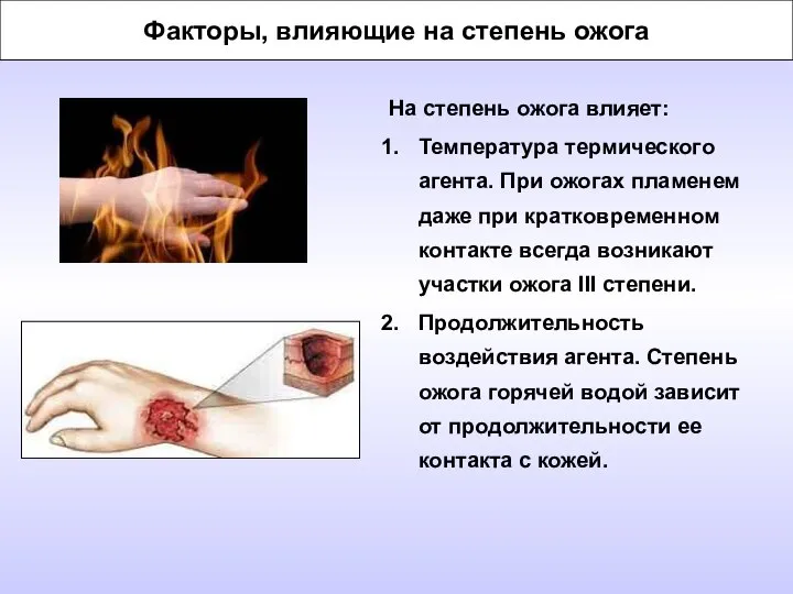 Факторы, влияющие на степень ожога На степень ожога влияет: Температура термического