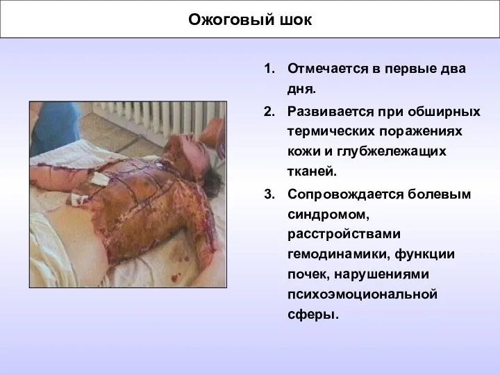 Ожоговый шок Отмечается в первые два дня. Развивается при обширных термических