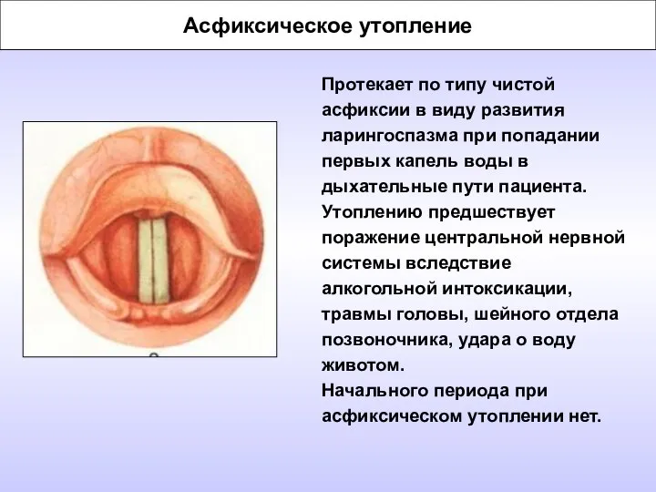 Асфиксическое утопление Протекает по типу чистой асфиксии в виду развития ларингоспазма