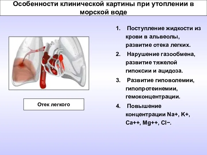Особенности клинической картины при утоплении в морской воде Поступление жидкости из