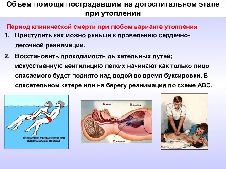 Объем помощи пострадавшим на догоспитальном этапе при утоплении Период клинической смерти