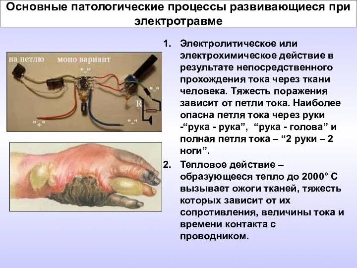 Основные патологические процессы развивающиеся при электротравме Электролитическое или электрохимическое действие в