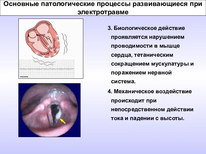 Основные патологические процессы развивающиеся при электротравме 3. Биологическое действие проявляется нарушением