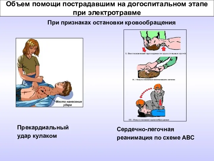 Объем помощи пострадавшим на догоспитальном этапе при электротравме При признаках остановки