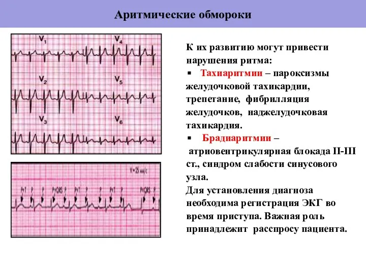 Аритмические обмороки К их развитию могут привести нарушения ритма: Тахиаритмии –