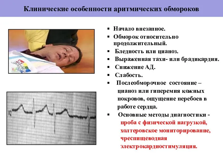 Клинические особенности аритмических обмороков Начало внезапное. Обморок относительно продолжительный. Бледность или