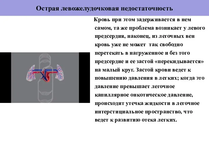 Острая левожелудочковая недостаточность Кровь при этом задерживается в нем самом, та