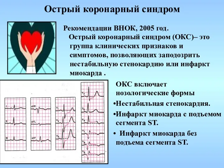 Острый коронарный синдром Рекомендации ВНОК, 2005 год. Острый коронарный синдром (ОКС)–