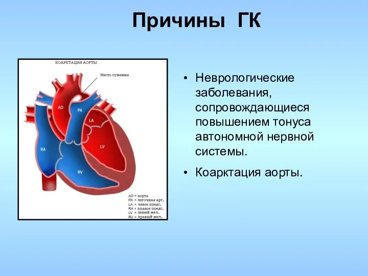 Неврологические заболевания, сопровождающиеся повышением тонуса автономной нервной системы. Коарктация аорты. Причины ГК