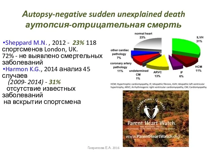 Аutopsy-negative sudden unexplained death аутопсия-отрицательная смерть Sheppard M.N. , 2012 -