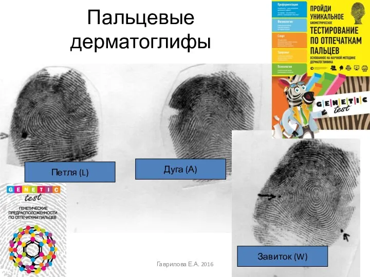Пальцевые дерматоглифы Петля (L) Завиток (W) Дуга (А) Гаврилова Е.А. 2016